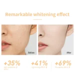 ⁦LANBENA NIACINAMIDE MOISTURIZER 30G⁩ - الصورة ⁦2⁩