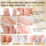 ⁦lanbena foot peeling mask 3pcs offer⁩ - الصورة ⁦5⁩