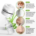 ⁦LANBENA PLANTS PORE STRIPS SET⁩ - الصورة ⁦2⁩